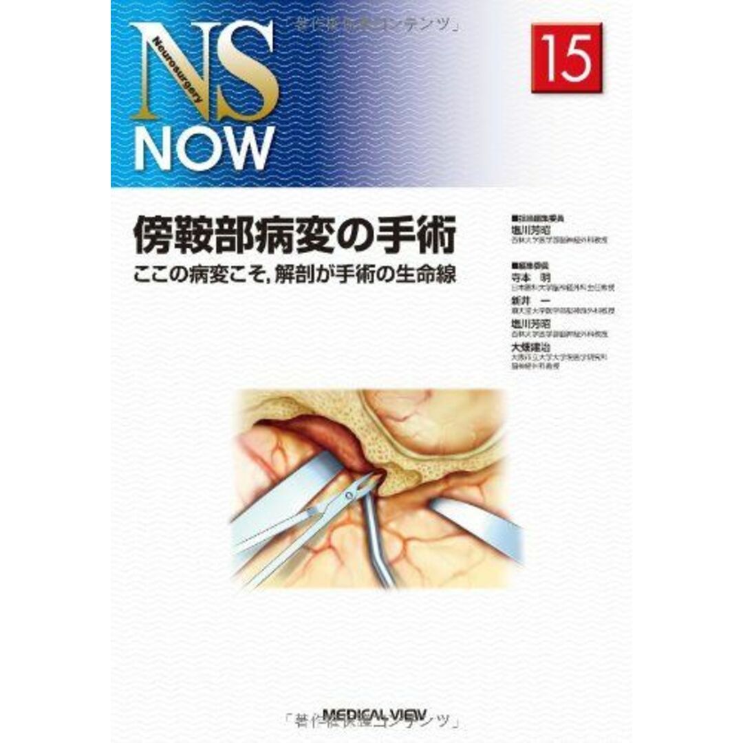 傍鞍部病変の手術?ここの病変こそ，解剖が手術の生命線 (NS NOW No.15) 芳昭，塩川