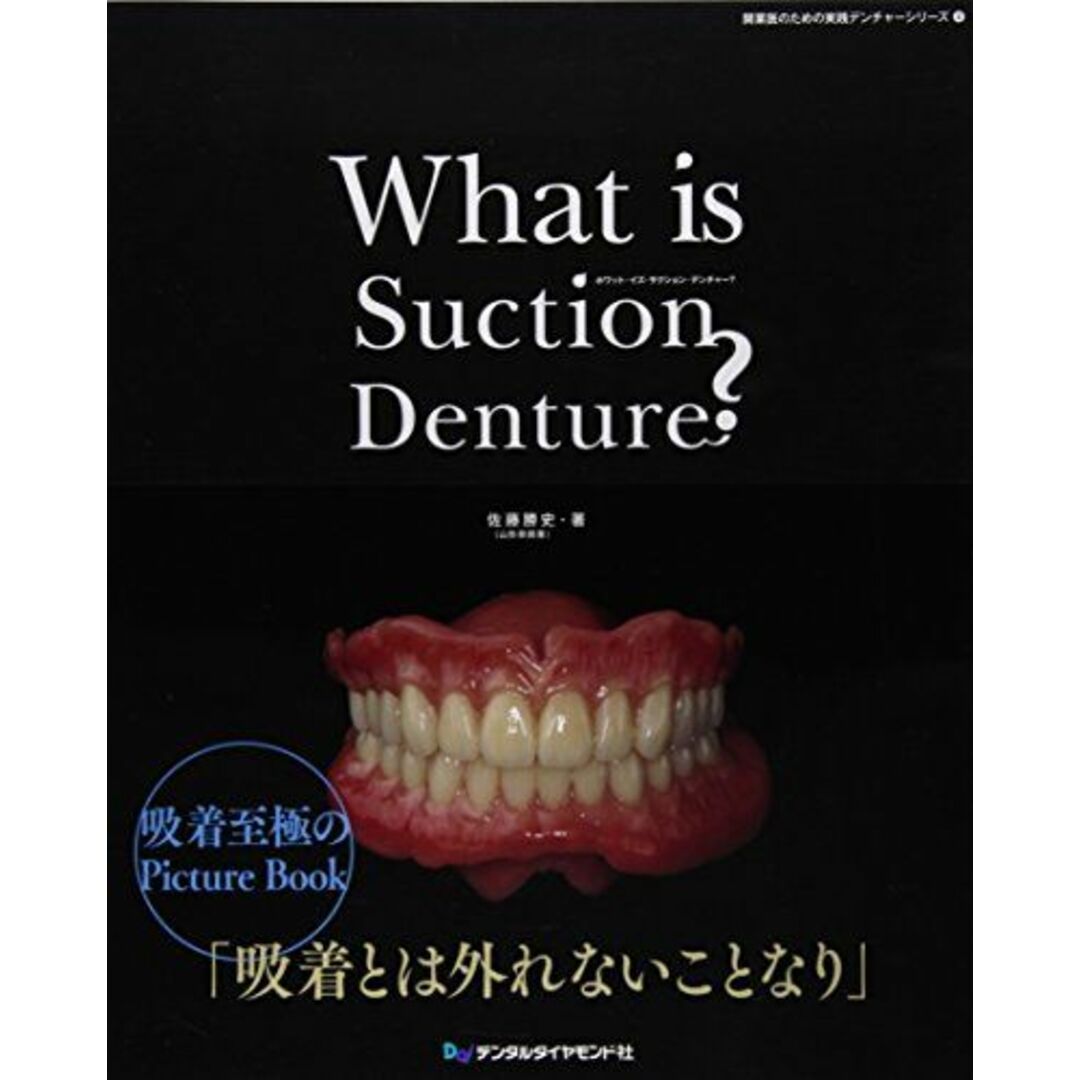 What is Suction Denture? (開業医のための実践デンチャーシリーズ 4) [大型本] 佐藤 勝史