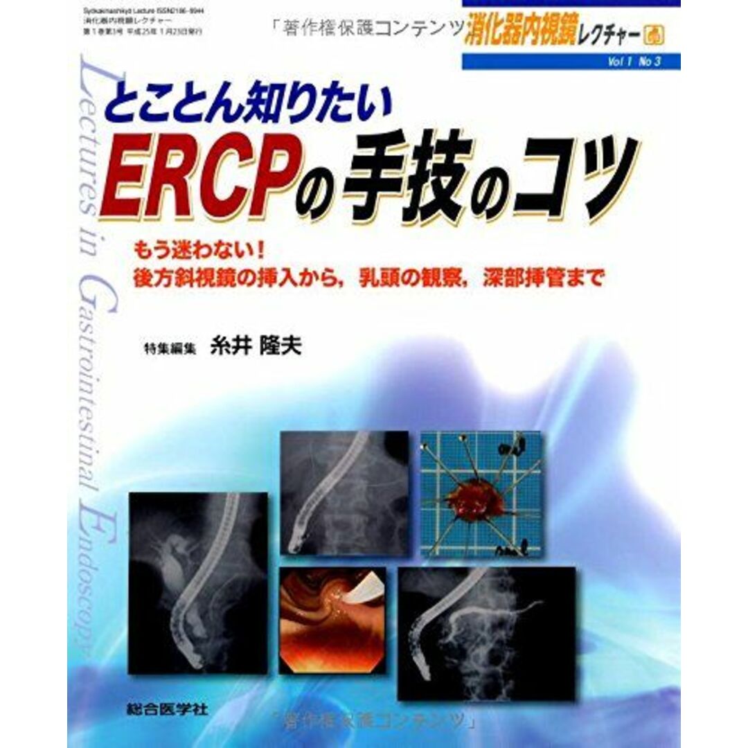 糸井隆夫消化器内視鏡レクチャー l‐3 とことん知りたいERCPの手技のコツ (消化器内視鏡レクチャー Vol 1-3) [大型本] 糸井 隆夫