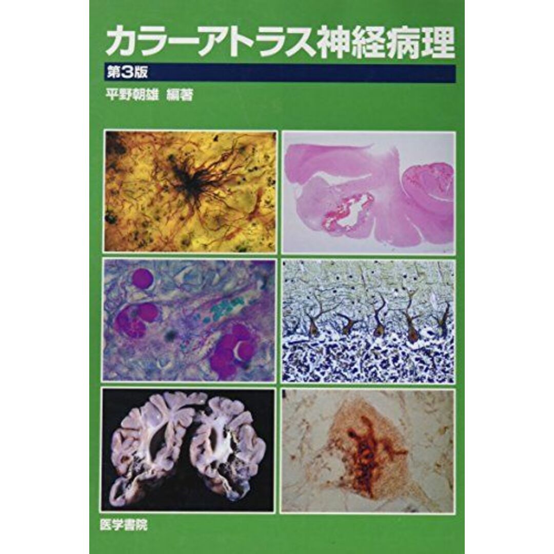 カラーアトラス神経病理 [大型本] 朝雄，平野