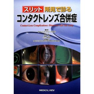 スリット所見で診る コンタクトレンズ合併症 [単行本] 潔，渡邉、 直之，前田; 日本コンタクトレンズ学会(語学/参考書)