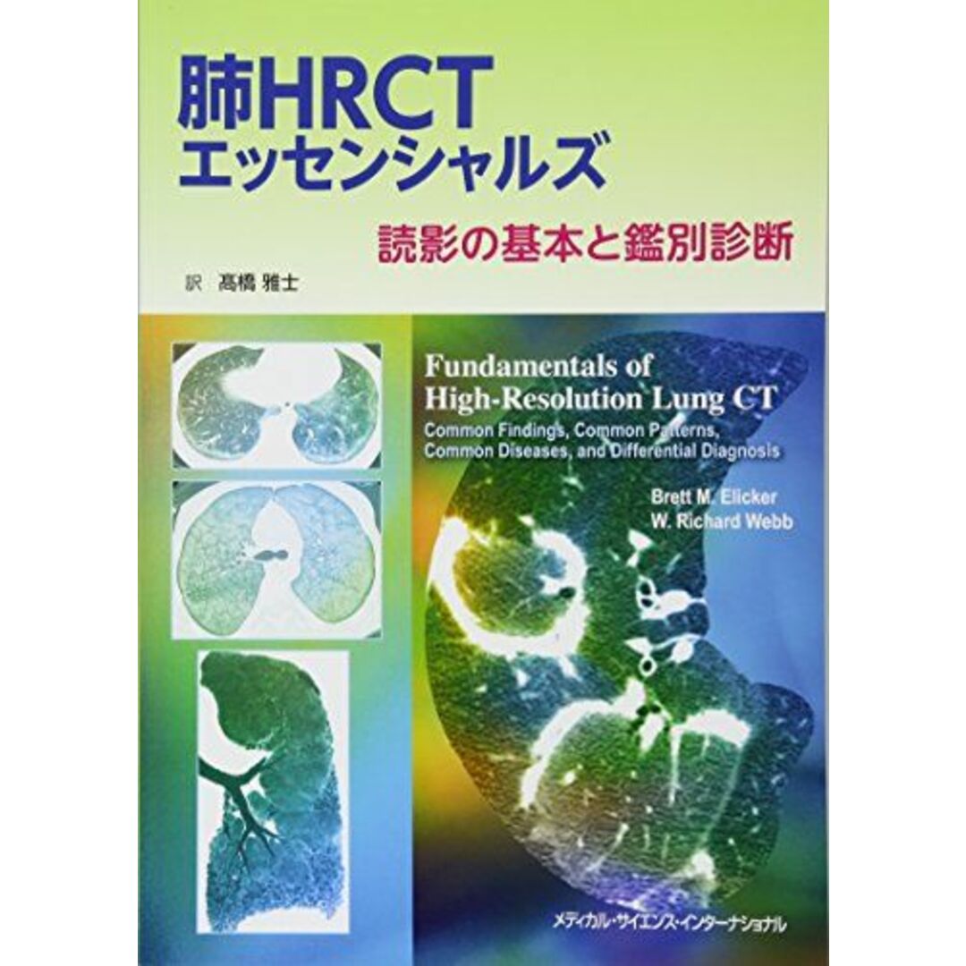 肺HRCTエッセンシャルズ 読影の基本と鑑別診断 [単行本（ソフトカバー）] 高橋雅士