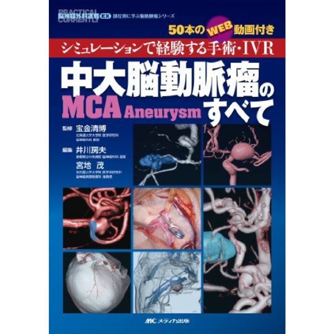 中大脳動脈瘤(MCA Aneurysm)のすべて: シミュレーションで経験する手術・IVR 50本のWEB動画付き (脳神経外科速報EX部位別に学ぶ脳動脈瘤シリーズ) [単行本] 宝金 清博、 井川 房夫; 宮地 茂