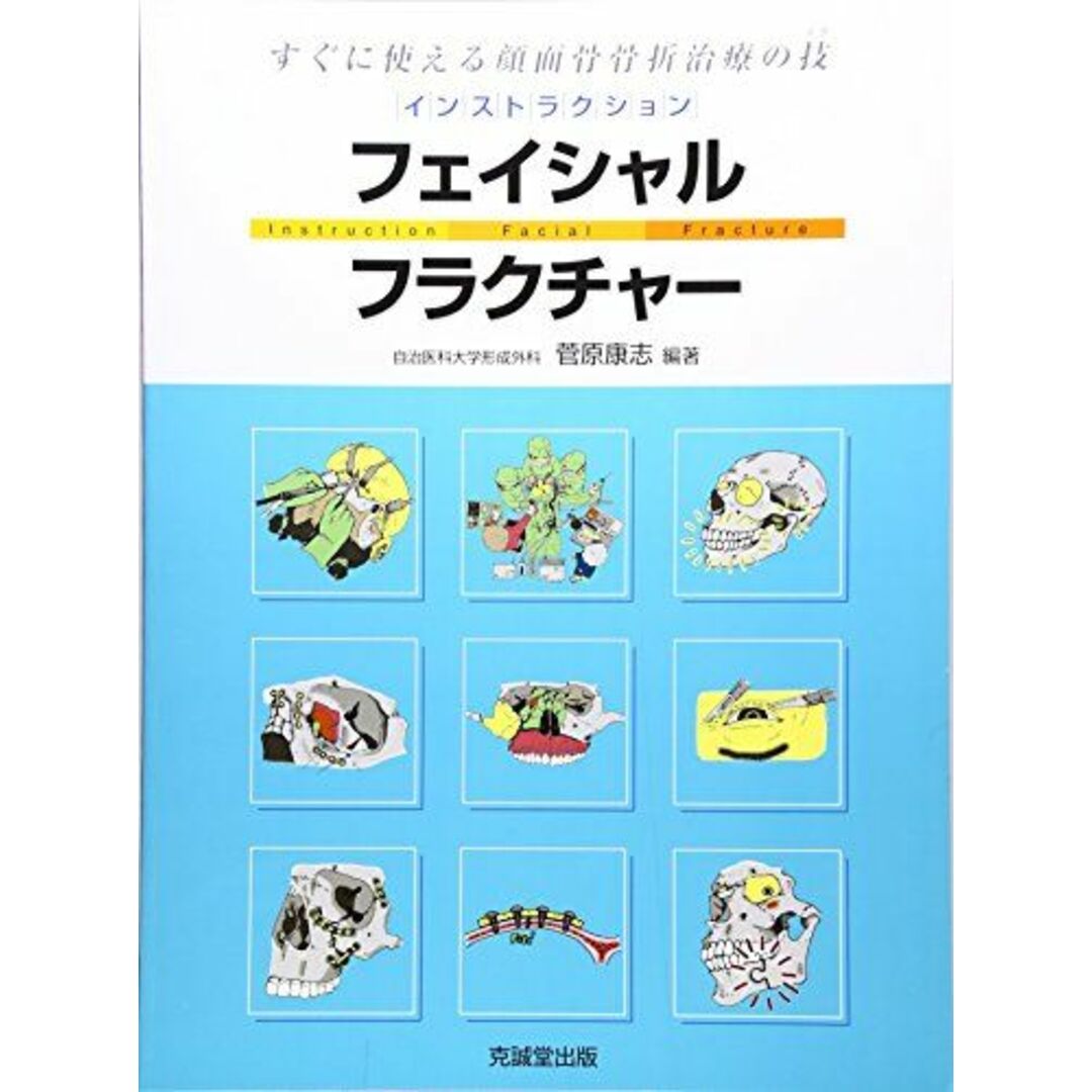 インストラクション・フェイシャルフラクチャー―すぐに役立つ顔面骨折治療の技(テク) [大型本] 菅原 康志