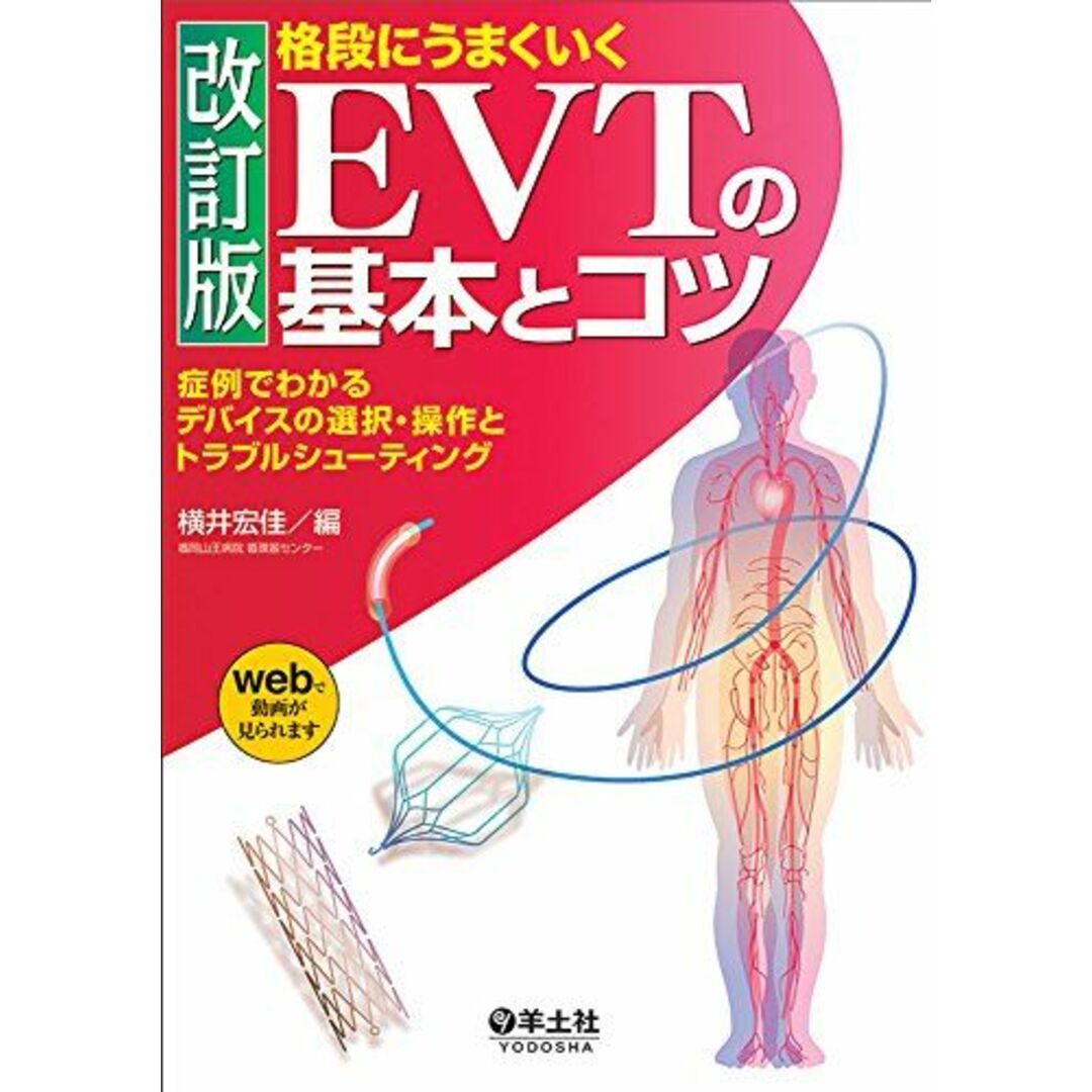 改訂版 格段にうまくいく EVTの基本とコツ?症例でわかるデバイスの選択・操作とトラブルシューティング