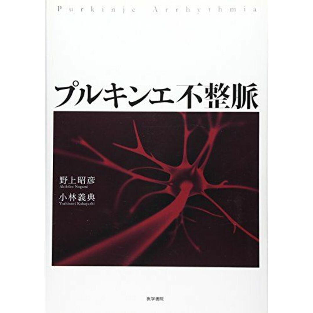 プルキンエ不整脈 [単行本] 昭彦，野上; 義典，小林