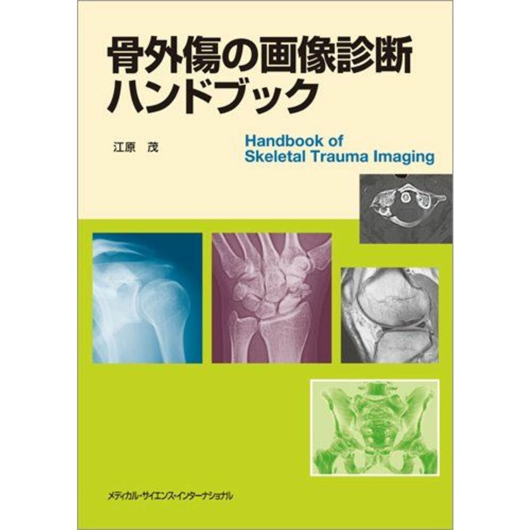 骨外傷の画像診断ハンドブック [単行本] 江原 茂