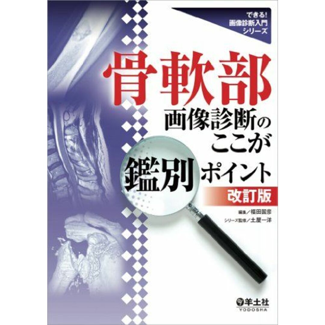 骨軟部画像診断のここが鑑別ポイント改訂版 (できる! 画像診断入門シリーズ) [単行本（ソフトカバー）] 福田 国彦