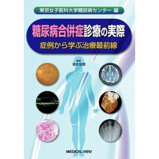 東京女子医科大学糖尿病センター編 糖尿病合併症診療の実際?症例から学ぶ治療最前線 東京女子医科大学糖尿病センター(語学/参考書)