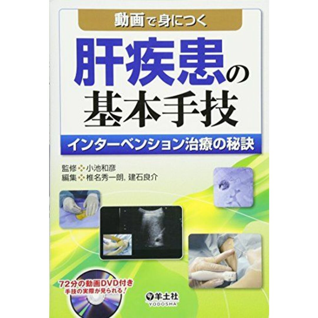 動画で身につく肝疾患の基本手技―インターベンション治療の秘訣 [単行本] 小池 和彦、 椎名 秀一朗; 建石 良介