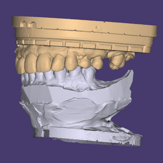 あなたの歯を３Dスキャン　身元確認、地震、災害、USBメモリにデータ保存して発送(その他)