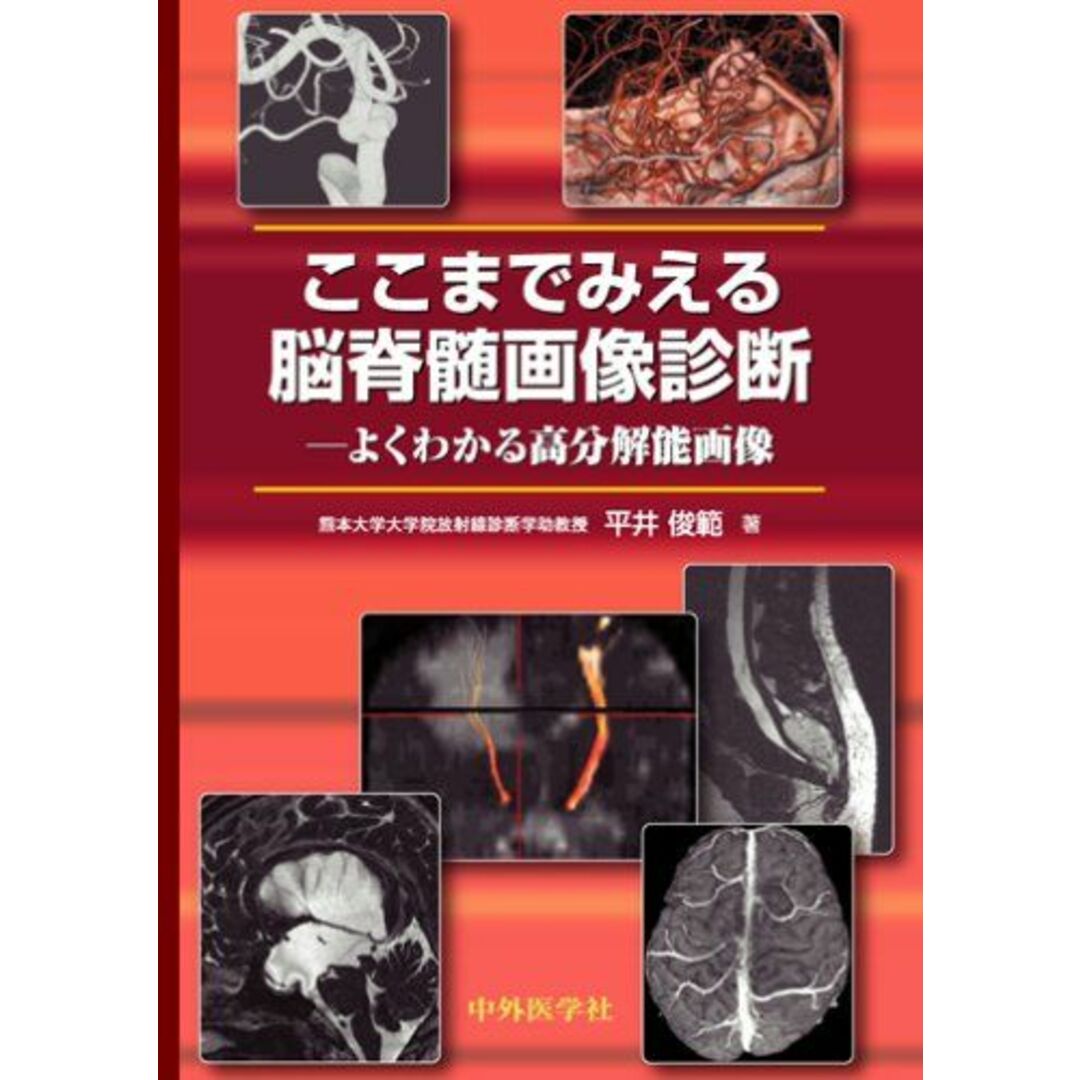 ここまでみえる脳脊髄画像診断―よくわかる高分解能画像 [単行本] 平井俊範