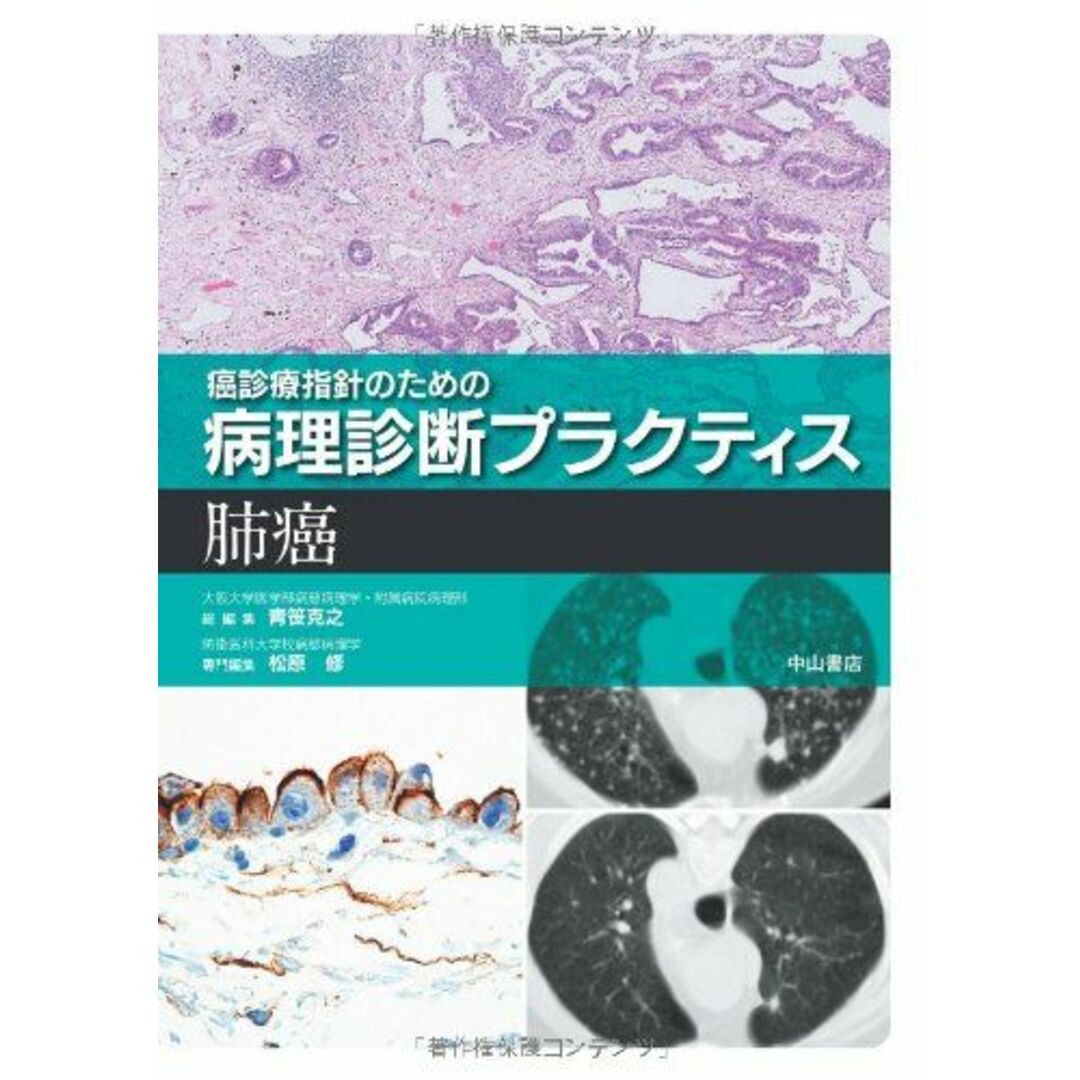 癌診療指針のための病理診断プラクティス 肺癌 [単行本] 克之，青笹; 修，松原