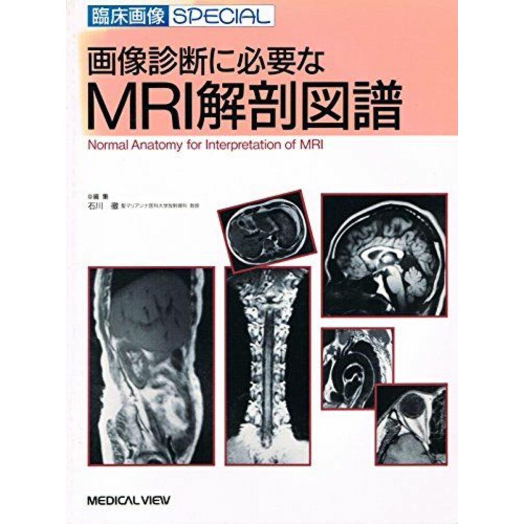 画像診断に必要なMRI解剖図譜 (臨床画像SPECIAL) 徹，石川