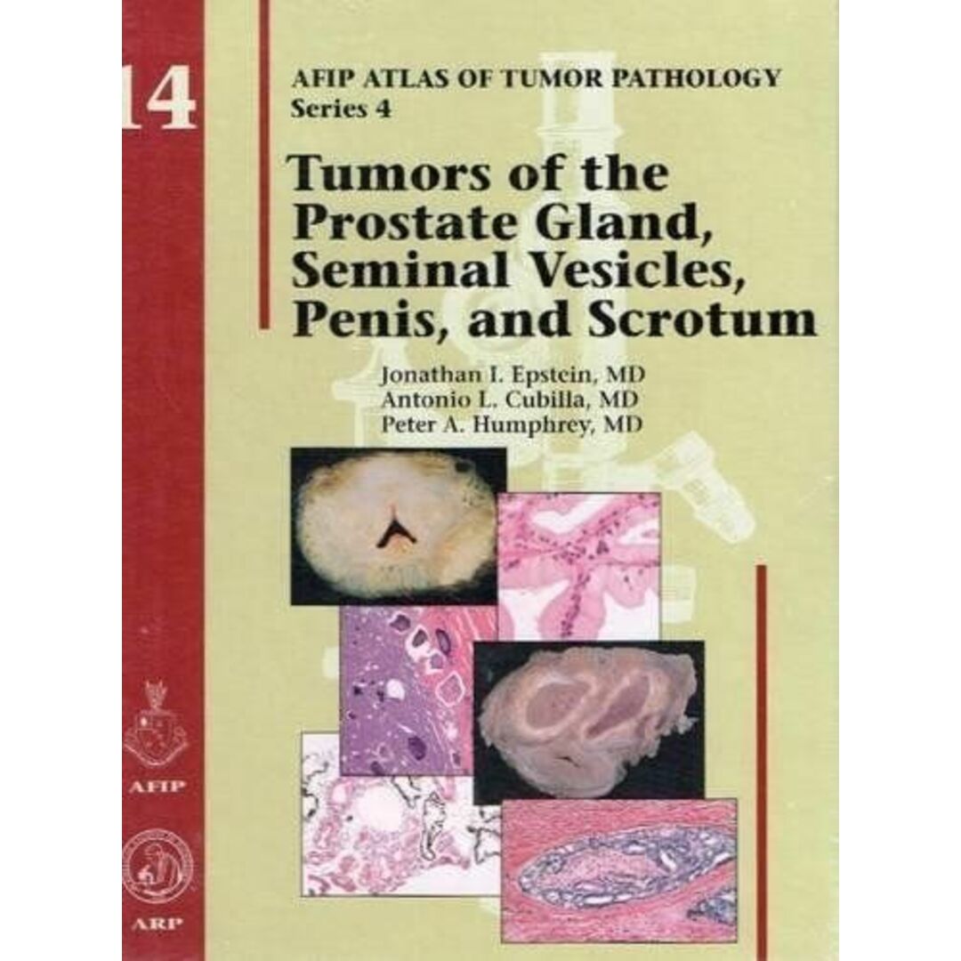 Tumors of the Prostate Gland，Seminal Vesicles，Penis，and Scrotum (AFIP Atlas of Tumor Pathology: Series 4) Epstein，Jonathan I. エンタメ/ホビーの本(語学/参考書)の商品写真