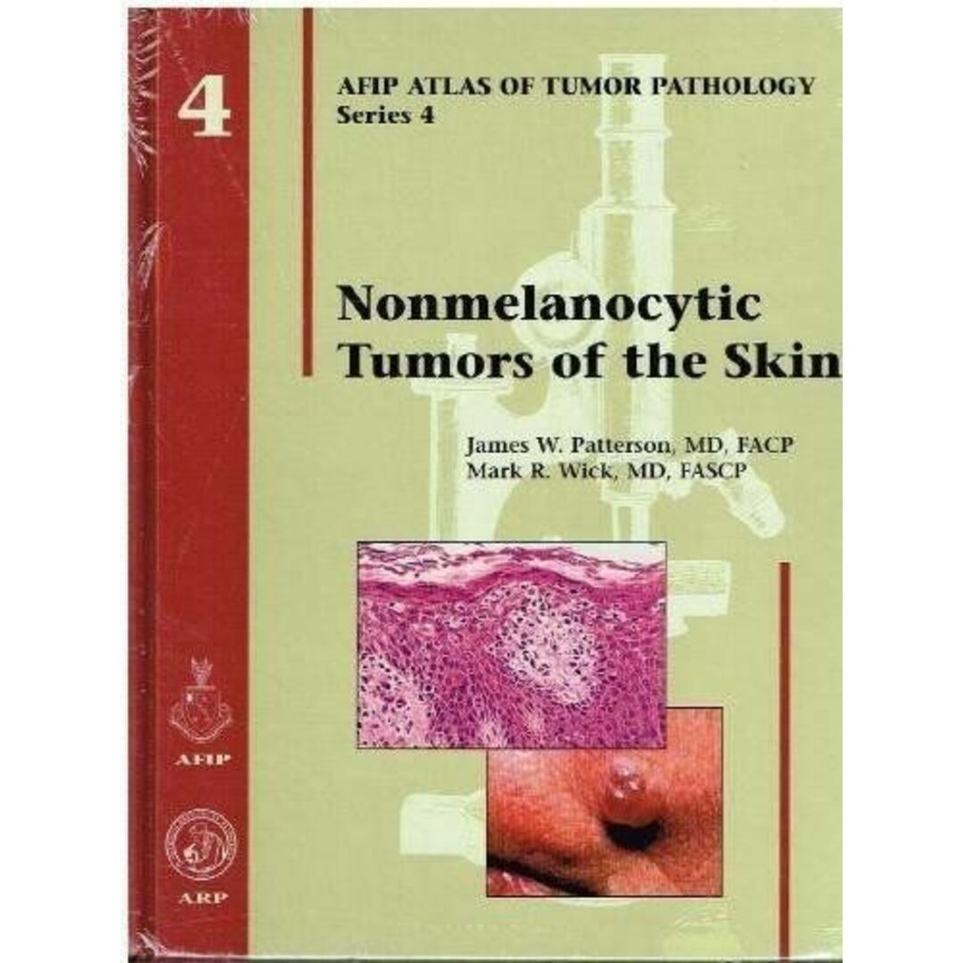 Nonmelanocytic Tumors of the Skin (Atlas of Tumor Pathology Series IV) [ハードカバー] Patterson，James W.