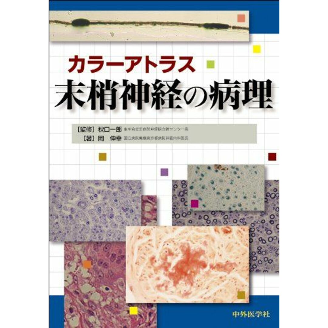 カラーアトラス末梢神経の病理 [大型本] 岡 伸幸; 秋口 一郎
