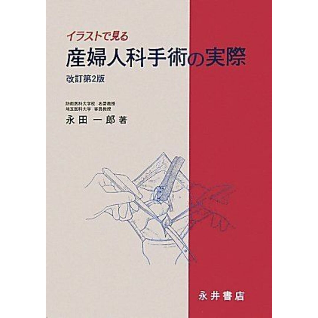 イラストで見る産婦人科手術の実際 [大型本] 永田 一郎