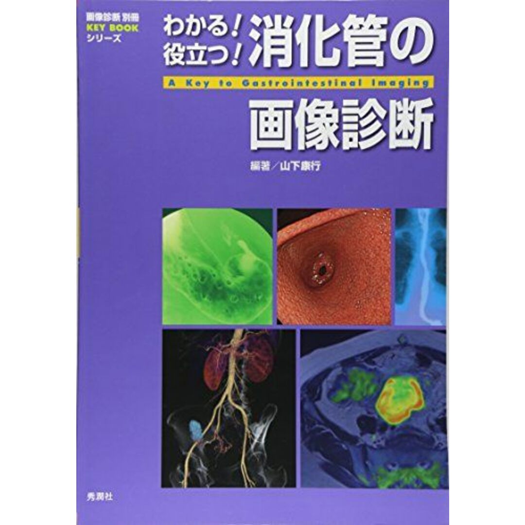 わかる! 役立つ! 消化管の画像診断 (画像診断別冊 KEYBOOK) [大型本] 山下康行