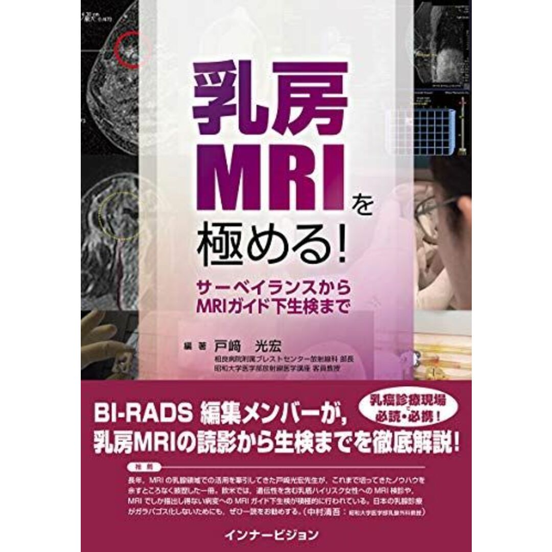 乳房MRIを極める! ─サーベイランスからMRIガイド下生検まで─ [単行本（ソフトカバー）] 戸? 光宏、 相良 安昭、 大井 恭代、 佐々木 道郎; 戸?光宏