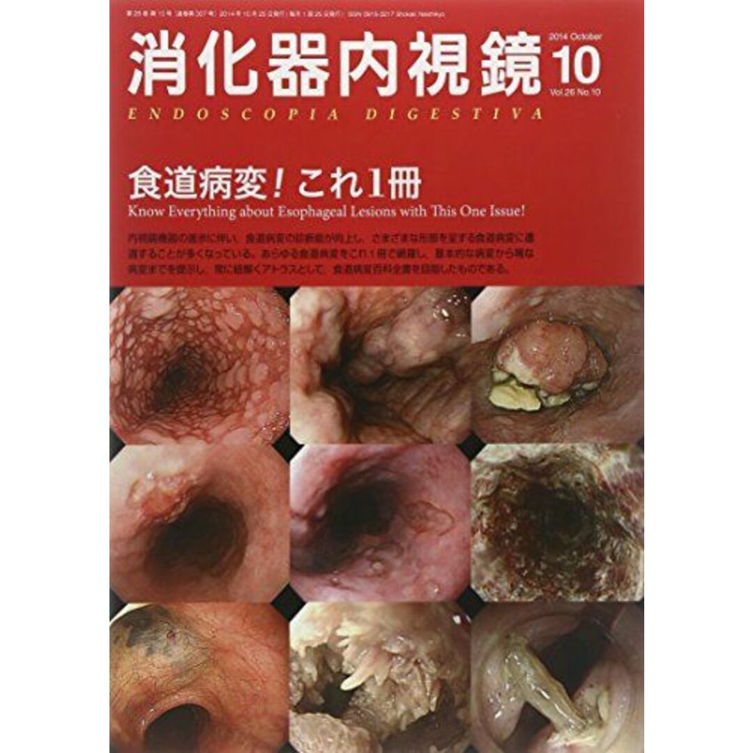 消化器内視鏡 14年10月号 26ー10 食道病変!これ1冊 消化器内視鏡編集委員会