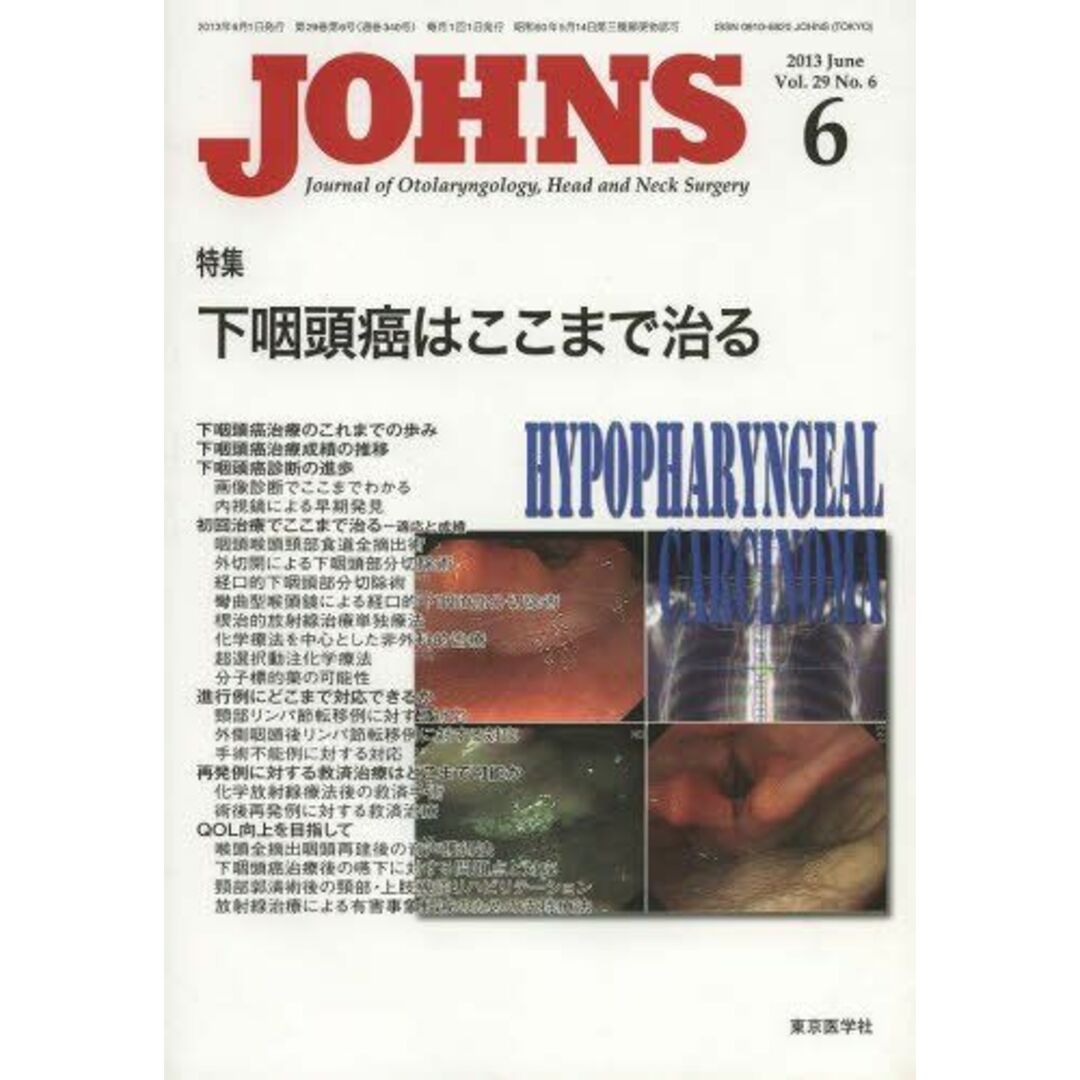 JOHNS第29巻6号 下咽頭癌はここまで治る (JOHNS2013年6月号) JOHNS編集委員会