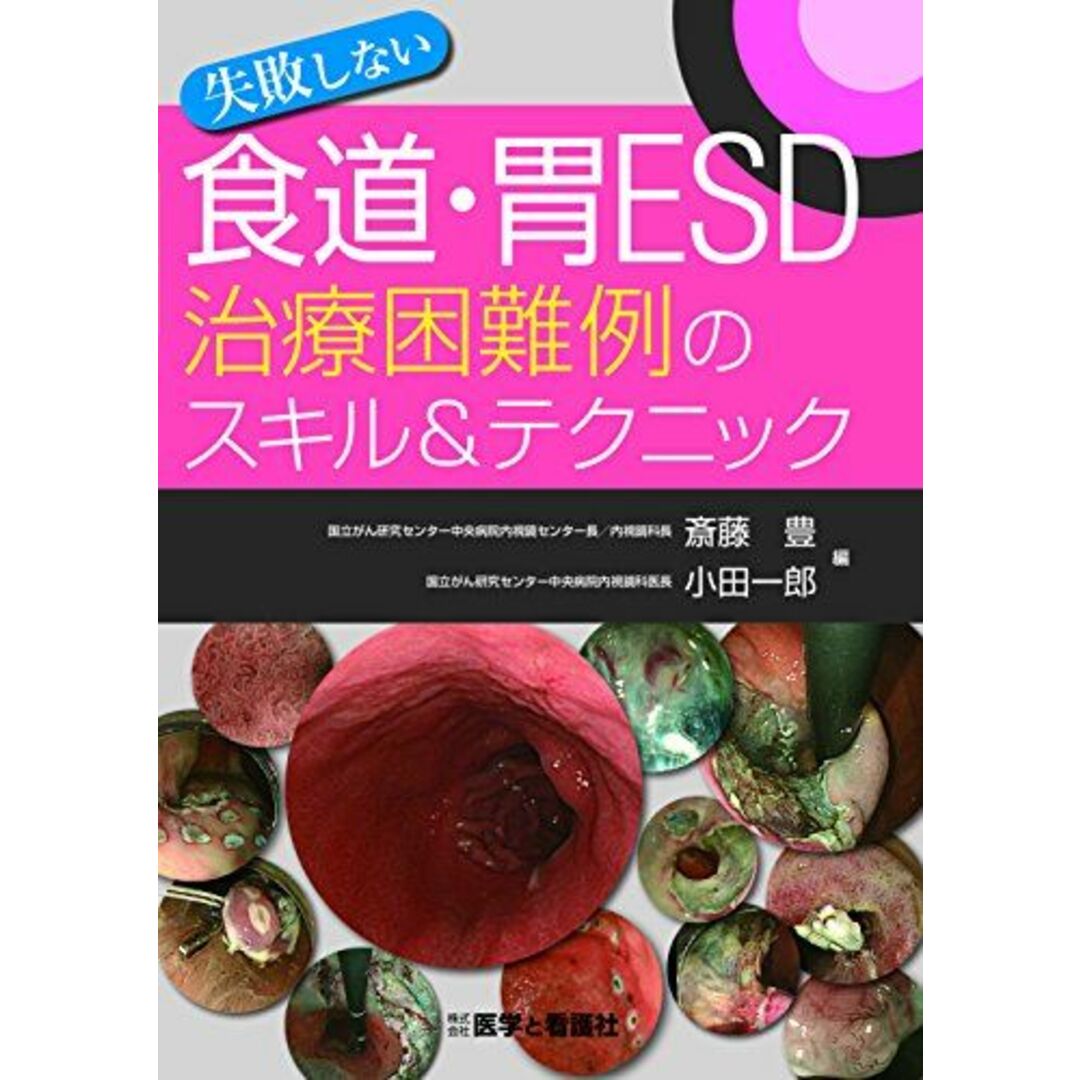 失敗しない食道・胃ESD治療困難例のスキル&テクニック [単行本] 斎藤 豊; 小田 一郎