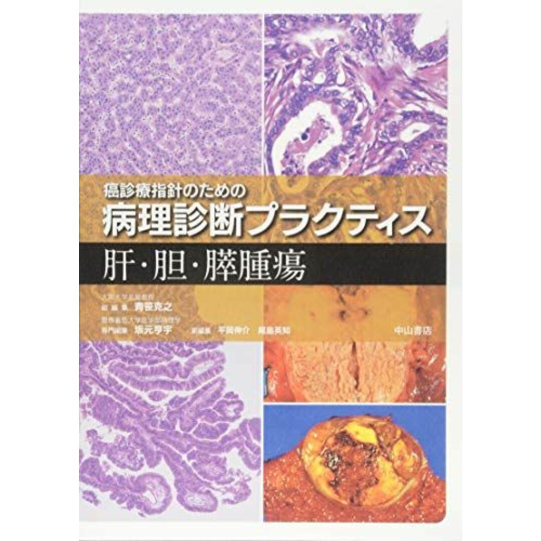 肝・胆・膵腫瘍 (癌診療指針のための病理診断プラクティス) [単行本] 坂元　亨宇、 尾島　英知、 平岡　伸介; 青笹克之