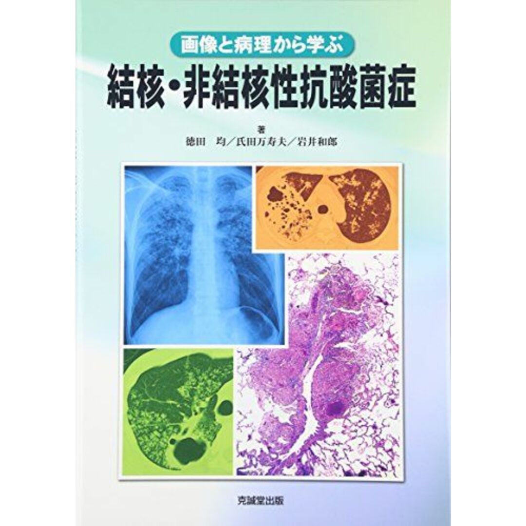 結核・非結核性抗酸菌症 [単行本（ソフトカバー）] 徳田 均、 氏田万寿夫; 岩井和郎ブックスドリーム出品一覧旺文社