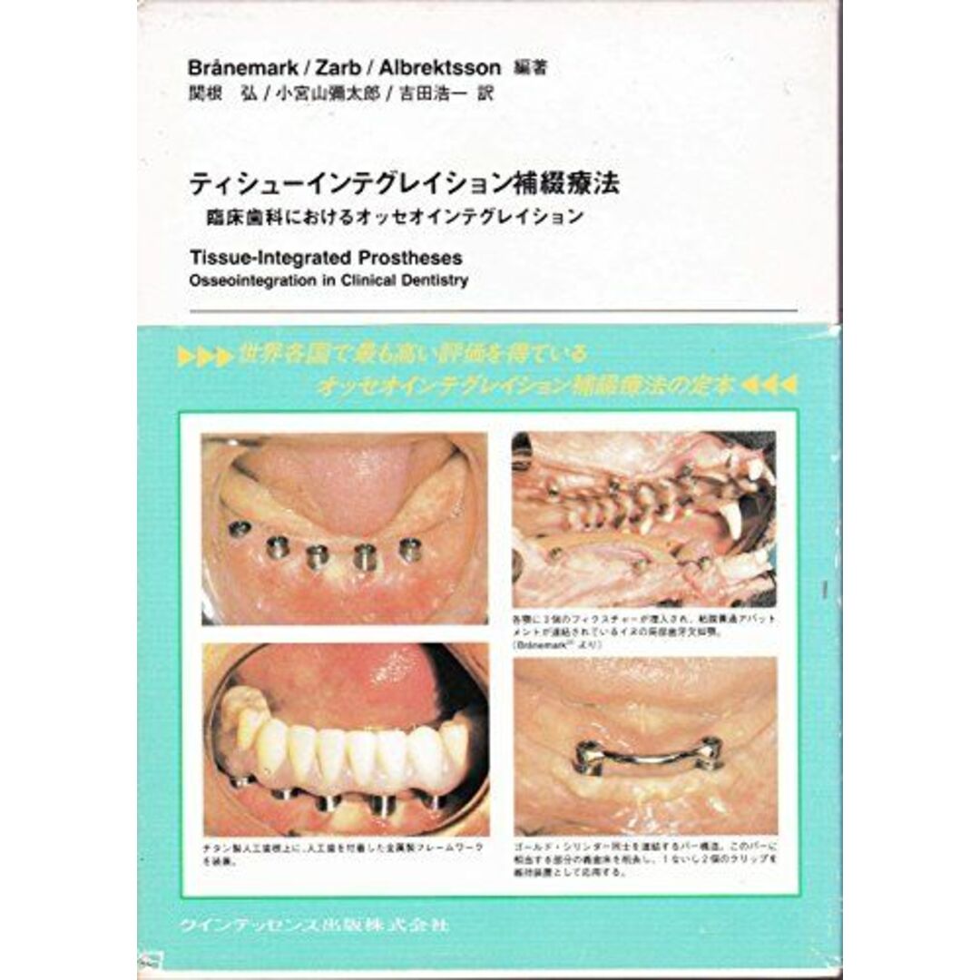 ティシューインテグレイション補綴療法―臨床歯科におけるオッセオインテグレイション P.I.ブローネマルク; 関根 弘