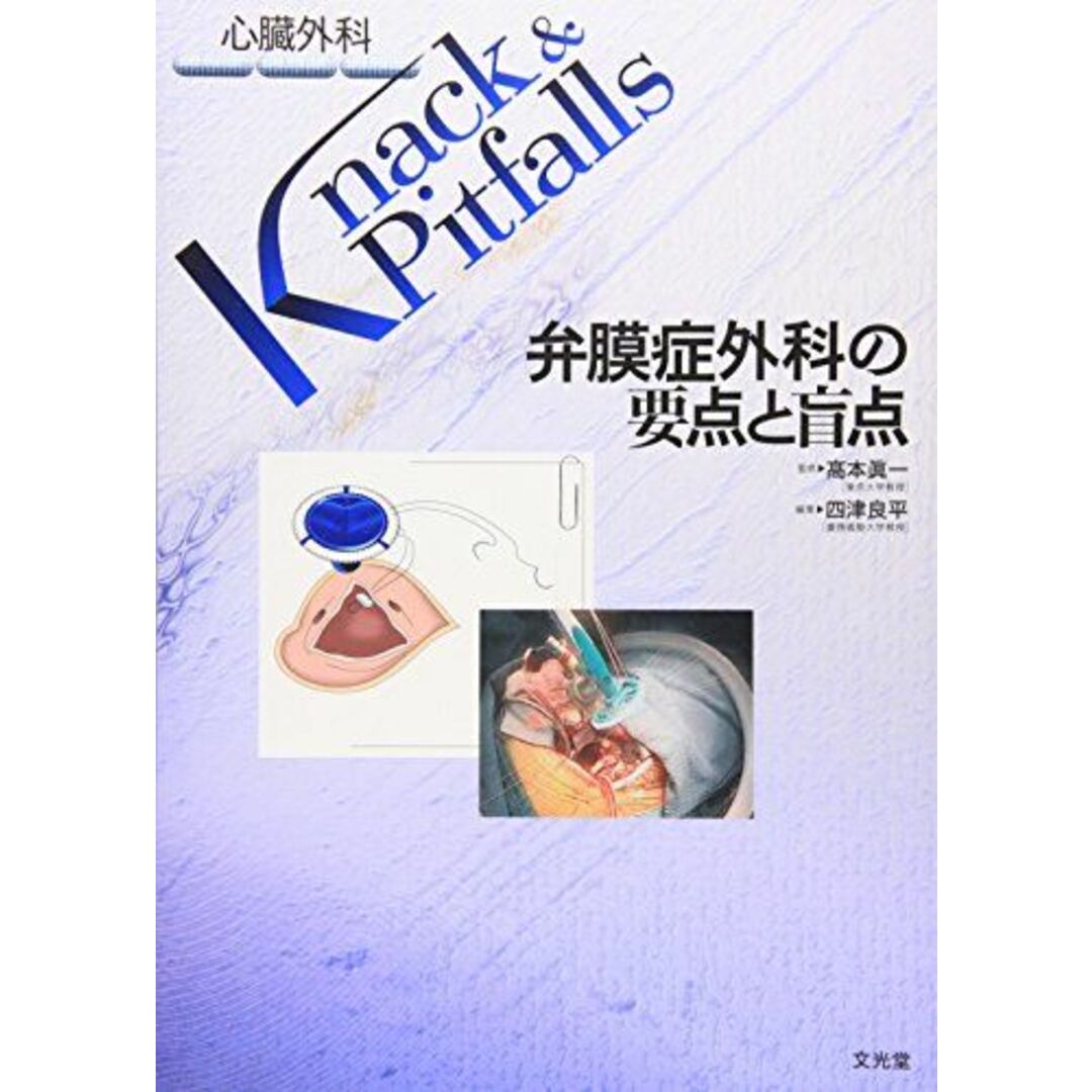 弁膜症外科の要点と盲点 (心臓外科Knack & Pitfalls) 眞一，高本; 良平，四津