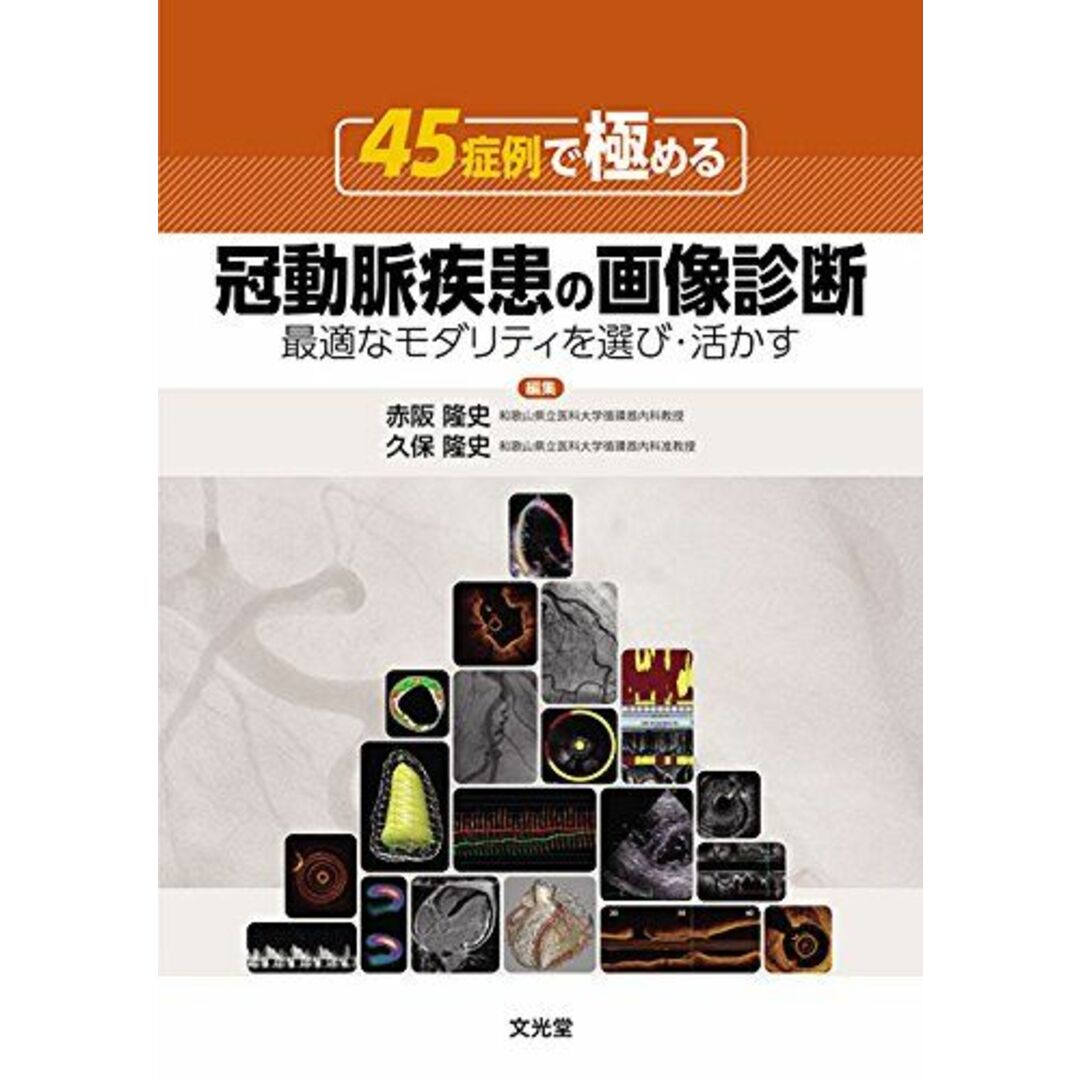 半額ストア 45症例で極める冠動脈疾患の画像診断―最適なモダリティを選び・活かす 隆史,久保 隆史,赤阪; 語学+参考書