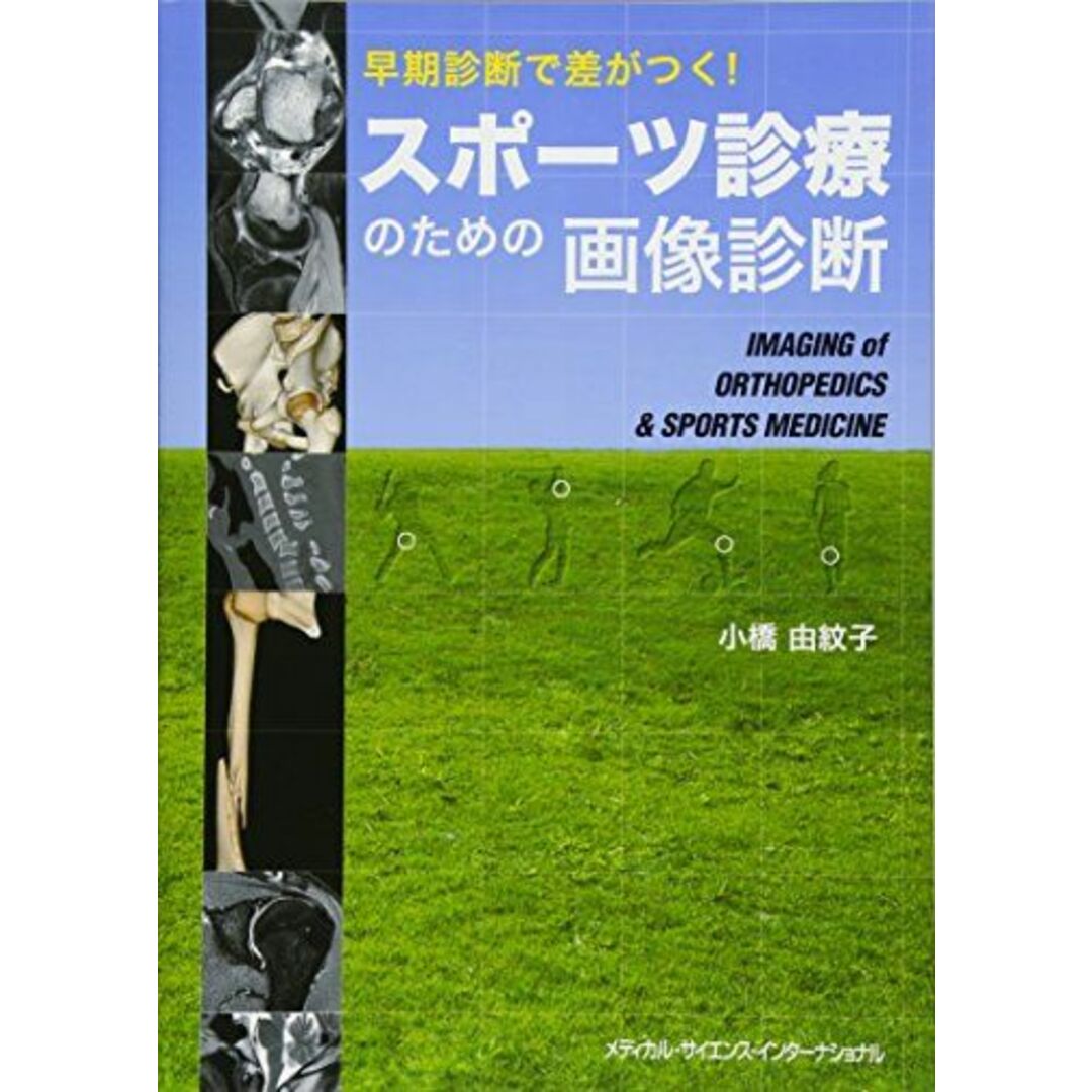 早期診断で差がつく! スポーツ診療のための画像診断 [単行本] 小橋由紋子