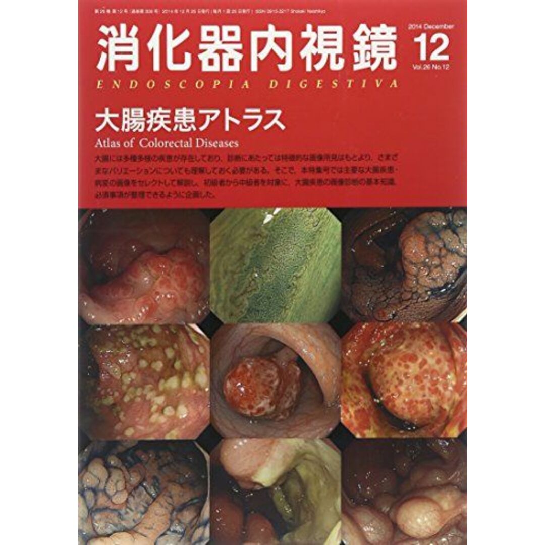 消化器内視鏡 14年12月号 26ー12 大腸疾患アトラス 消化器内視鏡編集委員会