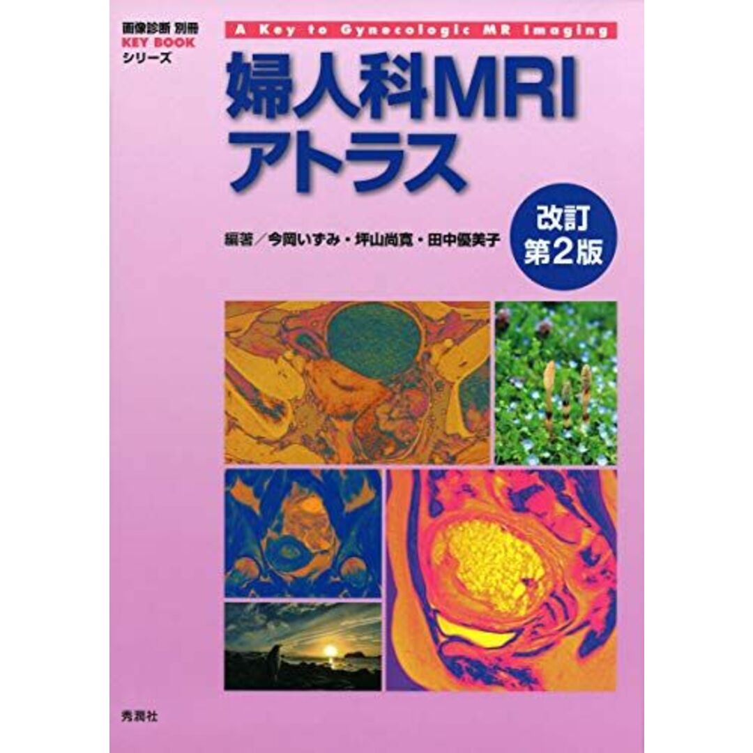 婦人科MRIアトラス 改訂第2版 (画像診断 別冊KEYBOOKシリーズ) [単行本] 今岡いずみ、 坪山尚寛; 田中優美子