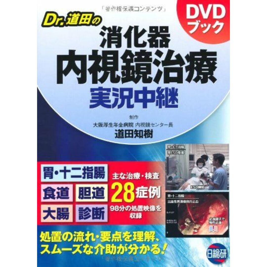 Dr.道田の消化器内視鏡治療実況中継―DVDブック 道田知樹