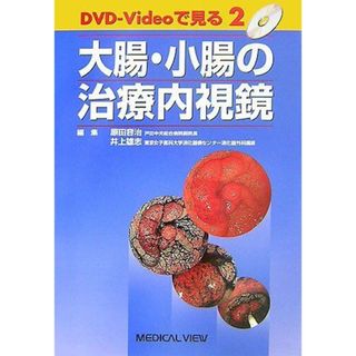 大腸・小腸の治療内視鏡 (DVD-Videoで見る治療内視鏡 2) 容治，原田; 雄志，井上(語学/参考書)