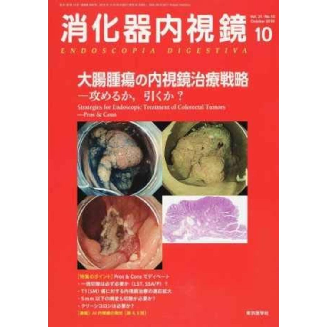 消化器内視鏡 Vol.31 No.10(20 大腸腫瘍の内視鏡治療戦略 消化器内視鏡編集委員会 エンタメ/ホビーの本(語学/参考書)の商品写真