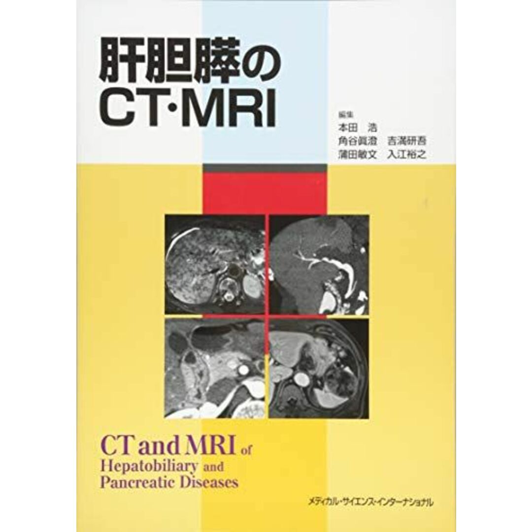 肝胆膵のCT・MRI