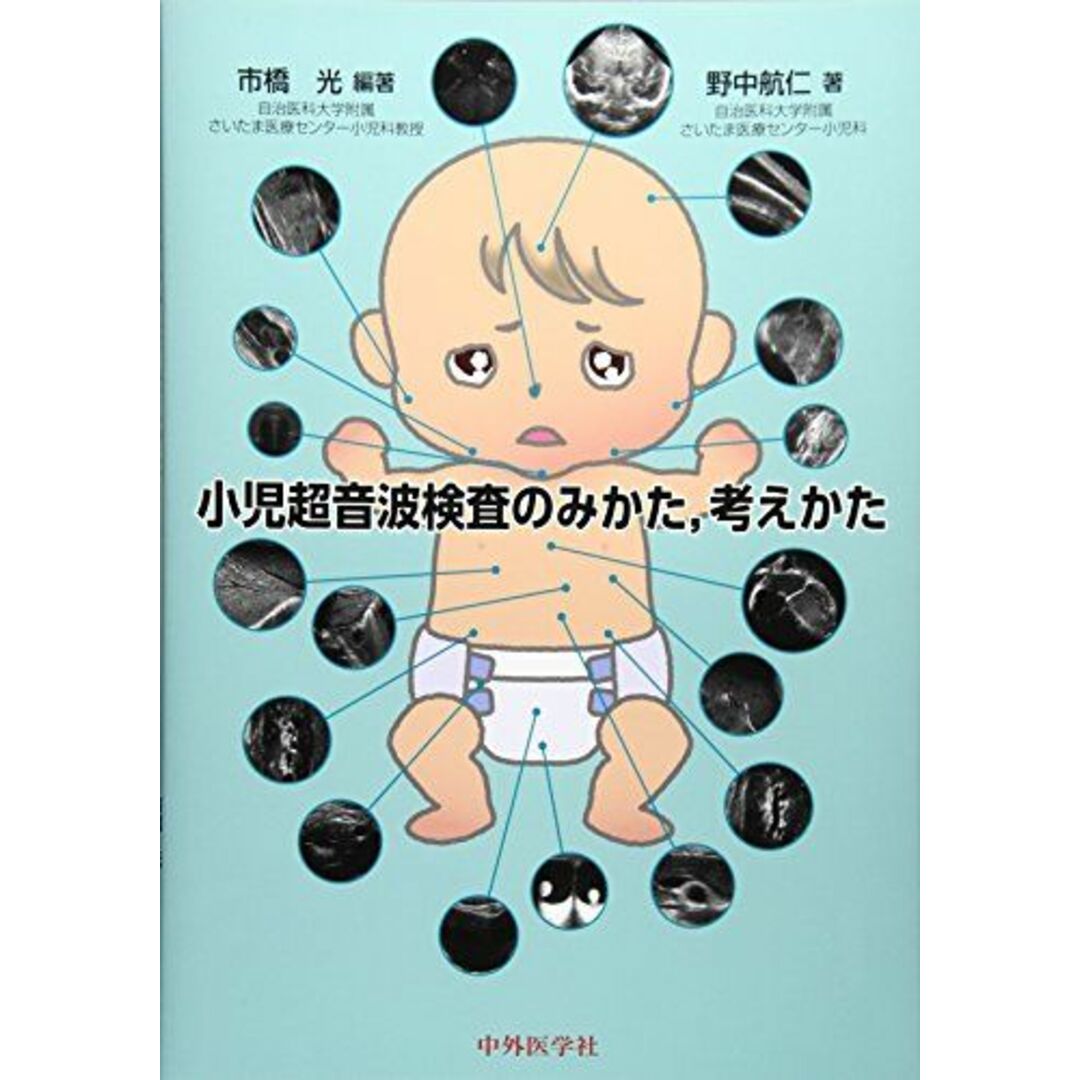 小児超音波検査のみかた，考えかた [単行本] 市橋光; 野中航仁