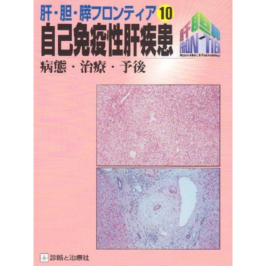 誕生日プレゼント 自己免疫性肝疾患―病態・治療・予後 (肝・胆・膵フロンティア 医学一般