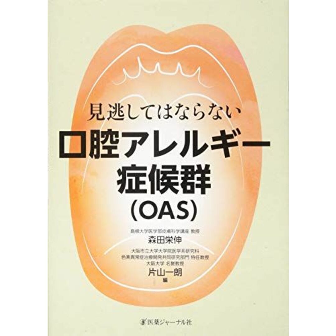 見逃してはならない口腔アレルギー症候群(OAS) 栄伸，森田; 一朗，片山