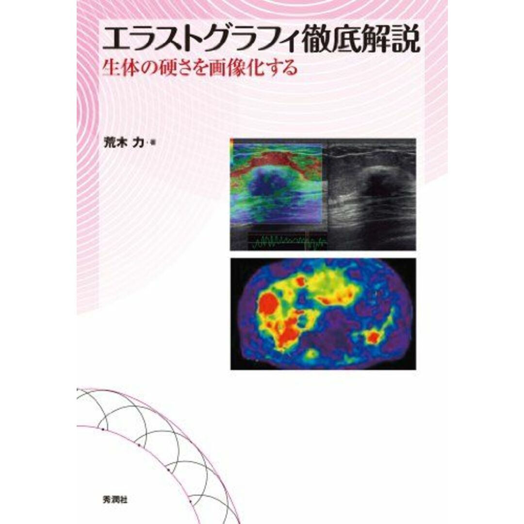 エラストグラフィ徹底解説: 生体の硬さを画像化する [単行本] 荒木 力