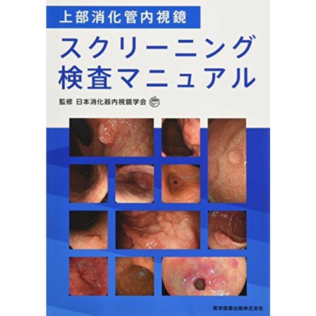 上部消化管内視鏡スクリー二ング検査マニュアル [大型本] 日本消化器内視鏡学会