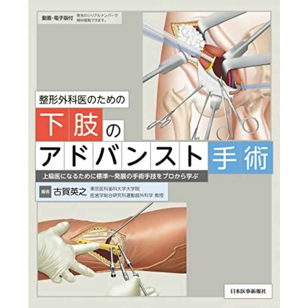 整形外科医のための下肢のアドバンスト手術 上級医になるために標準~発展の手術手技をプロから学ぶ ─ 電子版付 ─ 古賀英之