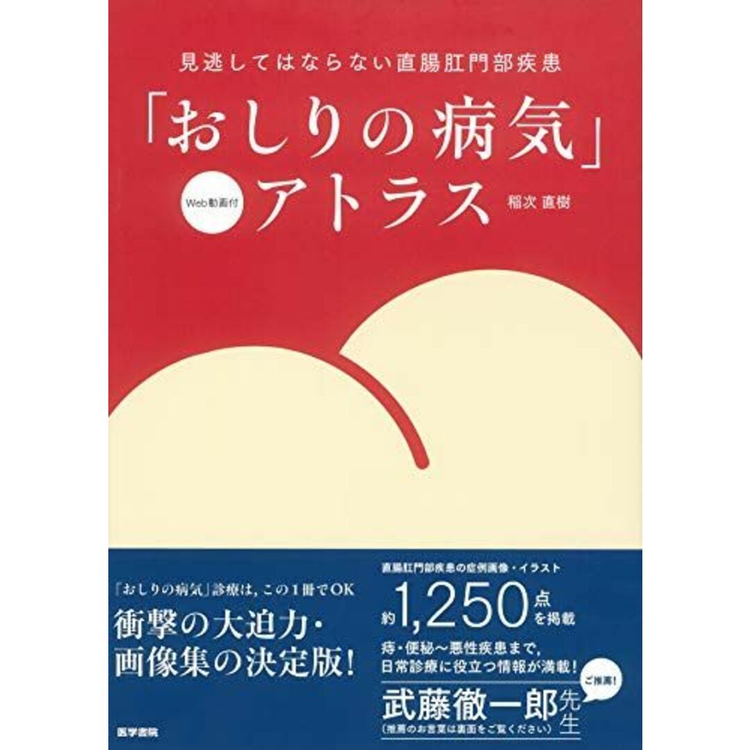 「おしりの病気」アトラス　[Web動画付] [単行本] 稲次 直樹