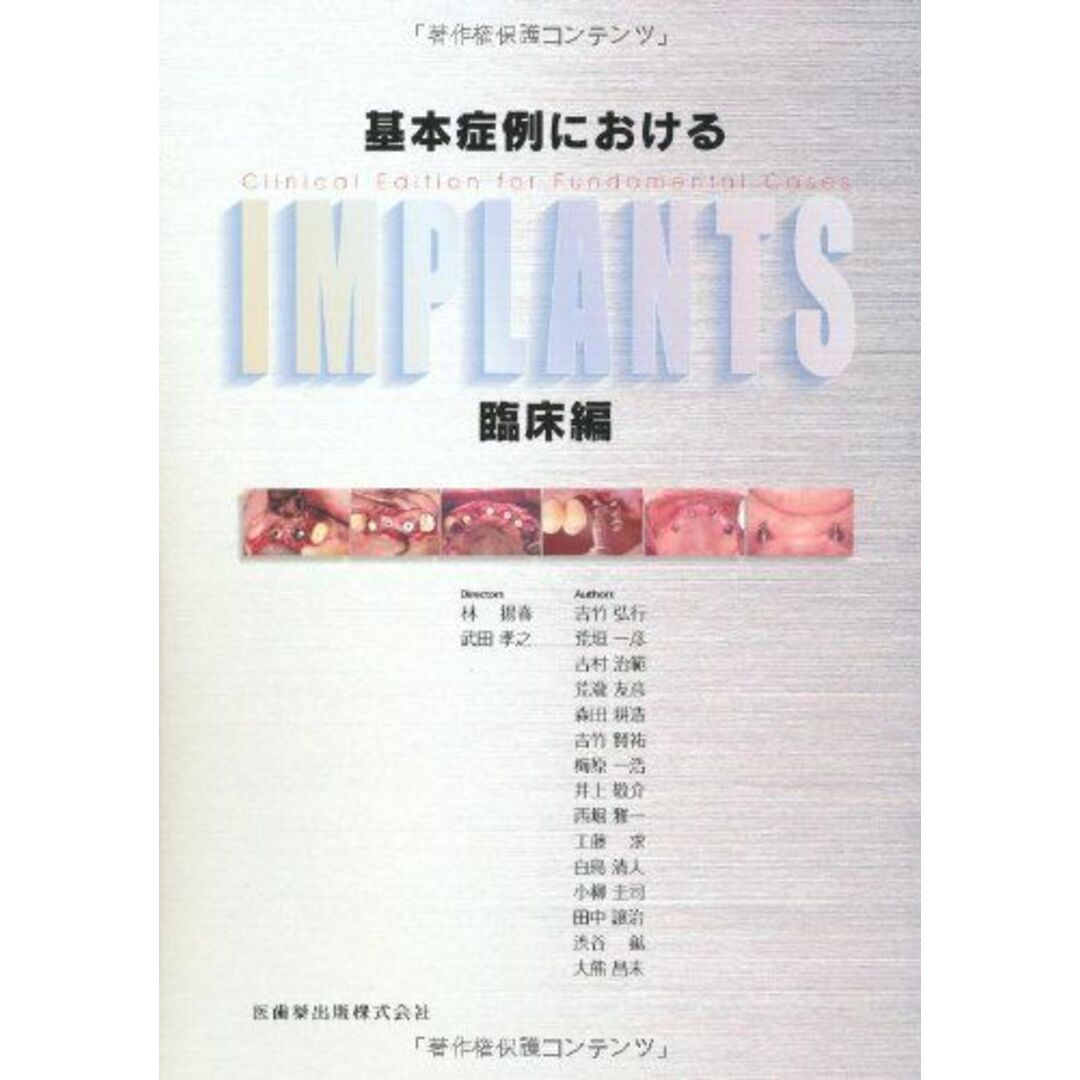 基本症例におけるIMPLANTS 臨床編 [単行本（ソフトカバー）] 林揚春、 武田孝之、 林 揚春; 武田 孝之