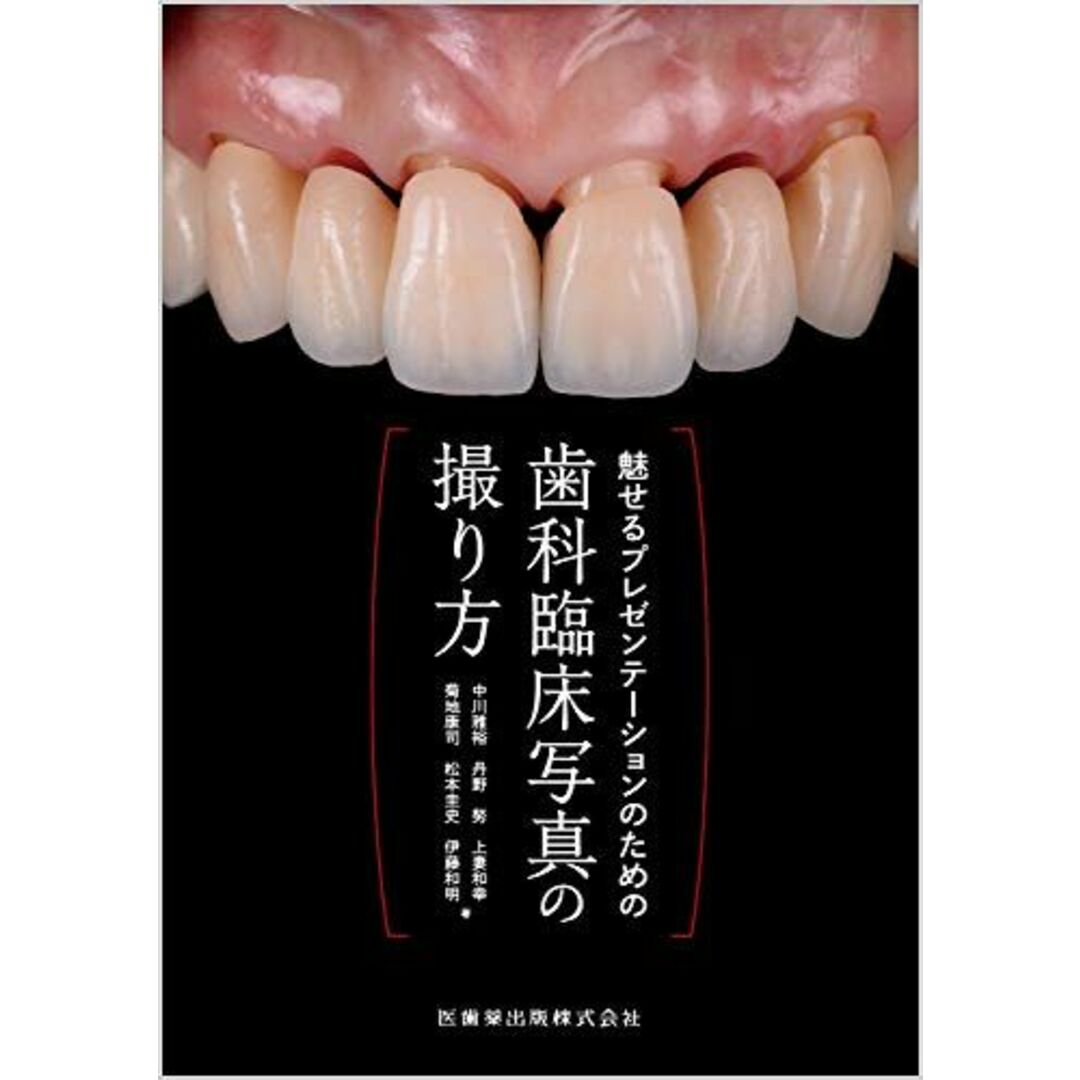 魅せるプレゼンテーションのための歯科臨床写真の撮り方