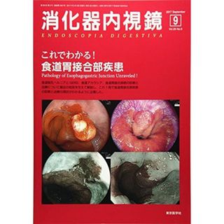 消化器内視鏡 Vol.29 No.9(201 これでわかる!食道胃接合部疾患 [単行本] 消化器内視鏡編集委員会(語学/参考書)