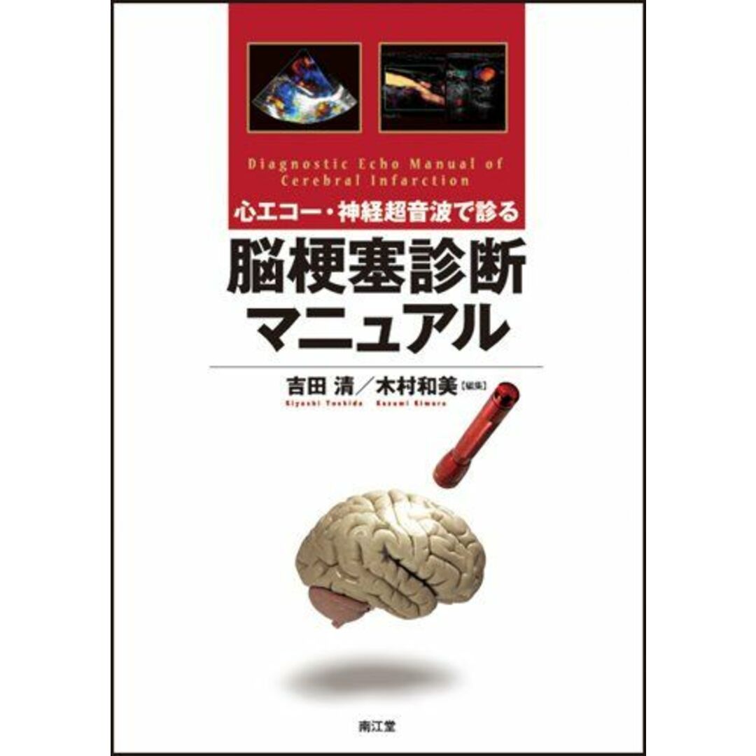 心エコー・神経超音波で診る脳梗塞診断マニュアル 吉田 清